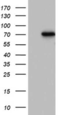 Western Blot: PARN Antibody (OTI4D12) - Azide and BSA Free [NBP2-73246] - Analysis of HEK293T cells were transfected with the pCMV6-ENTRY control (Left lane) or pCMV6-ENTRY PARN.