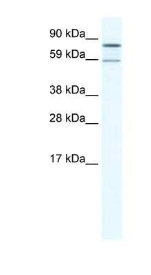 Western Blot: PARN Antibody [NBP1-80250] - SP2/0 cell lysate, concentration 1.25ug/ml.