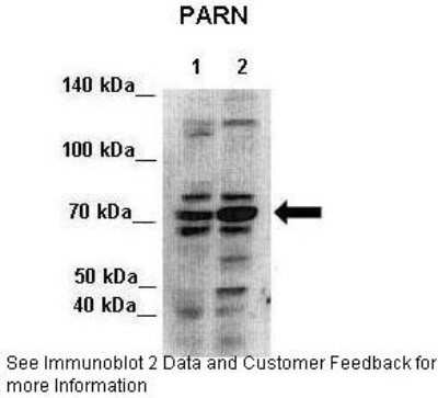 Western Blot: PARN Antibody [NBP1-80250] - Lanes: Lane 1 : 7ug HEK293 cytoplasmic lysate 2: 7ug HEK293 nuclei lysate Primary, Antibody Dilution: 1 : 500 Secondary Antibody: Anti-rabbit-HRP Secondary, Antibody Dilution: 1 : 500 Gene name: PARN.