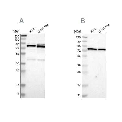 <b>Independent Antibodies Validation. </b>Western Blot: PARN Antibody [NBP1-84302] - Analysis using Anti-PARN antibody NBP1-84302 (A) shows similar pattern to independent antibody NBP1-84303 (B).