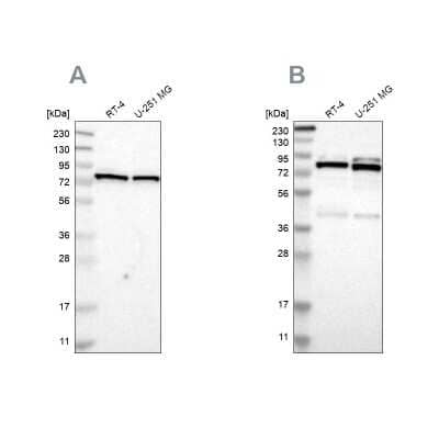 <b>Independent Antibodies Validation. </b>Western Blot: PARN Antibody [NBP1-84303] - Analysis using Anti-PARN antibody NBP1-84303 (A) shows similar pattern to independent antibody NBP1-84302 (B).