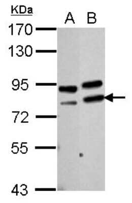 Western Blot: PARN Antibody [NBP2-19696] - Sample (30 ug of whole cell lysate) A: NIH-3T3 B: BCL-1 7. 5% SDS PAGE gel, diluted at 1:2000.