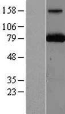 Western Blot: PARN Overexpression Lysate (Adult Normal) [NBL1-14109] Left-Empty vector transfected control cell lysate (HEK293 cell lysate); Right -Over-expression Lysate for PARN.