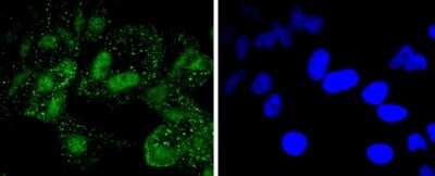 Immunocytochemistry/Immunofluorescence: PARP Antibody (SU03-68) [NBP2-67482] - Staining PARP in Hela cells (green). The nuclear counter stain is DAPI (blue). Cells were fixed in paraformaldehyde, permeabilised with 0.25% Triton X100/PBS.