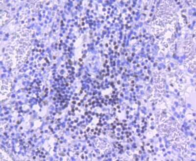 Immunohistochemistry-Paraffin: PARP Antibody (SU03-68) [NBP2-67482] - Analysis of paraffin-embedded human spleen tissue using anti-PARP antibody. Counter stained with hematoxylin.