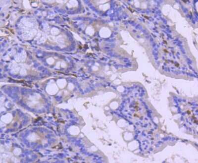 Immunohistochemistry-Paraffin: PARP Antibody (SU03-68) [NBP2-67482] - Analysis of paraffin-embedded mouse colon tissue using anti-PARP antibody. Counter stained with hematoxylin.