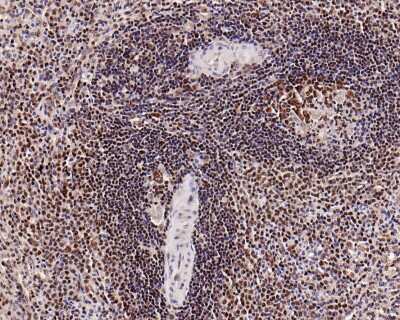 Immunohistochemistry-Paraffin: PARP Antibody (SU03-68) [NBP2-67482] - Analysis of paraffin-embedded human spleen tissue with Rabbit anti-PARP antibody washed with ddH2O and PBS, and then probed with the primary antibody  at 1/500 dilution for 1 hour at room temperature. The detection was performed using an HRP conjugated compact polymer system. DAB was used as the chromogen. Tissues were counterstained with hematoxylin and mounted with DPX.