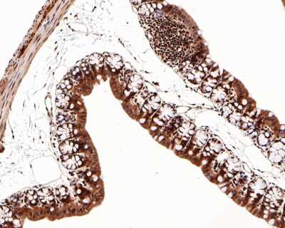 Immunohistochemistry-Paraffin: PARP Antibody (SU03-68) [NBP2-67482] - Analysis of paraffin-embedded mouse large intestine tissue with Rabbit anti-PARP antibody washed with ddH2O and PBS, and then probed with the primary antibody  at 1/500 dilution for 1 hour at room temperature. The detection was performed using an HRP conjugated compact polymer system. DAB was used as the chromogen. Tissues were counterstained with hematoxylin and mounted with DPX.