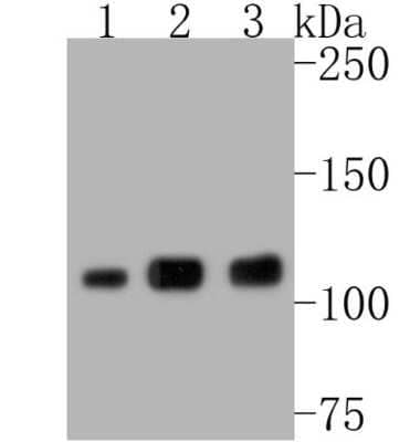 Western Blot: PARP Antibody (SU03-68) [NBP2-67482] - Analysis of PARP on different lysates. Proteins were transferred to a PVDF membrane and blocked with 5% BSA in PBS for 1 hour at room temperature. The primary antibody (1/500) was used in 5% BSA at room temperature for 2 hours. Goat Anti-Rabbit IgG - HRP Secondary Antibody at 1:5,000 dilution was used for 1 hour at room temperature. Positive control: Lane 1: A549 cell lysate Lane 2: Jurkat cell lysate Lane 3: Hela cell lysate