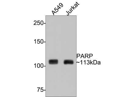 Western Blot: PARP Antibody (SU03-68) [NBP2-67482] - Analysis of PARP on different lysates with Rabbit anti-PARP antibody at 1/500 dilution. Lane 1: A549 cell lysate Lane 2: Jurkat cell lysate Lysates/proteins at 10 ug/Lane. Predicted band size: 113 kDa Observed band size: 113 kDa Exposure time: 1 minute; 6% SDS-PAGE gel. Proteins were transferred to a PVDF membrane and blocked with 5% NFDM/TBST for 1 hour at room temperature. The primary antibody at 1/500 dilution was used in 5% NFDM/TBST at room temperature for 2 hours. Goat Anti-Rabbit IgG - HRP Secondary Antibody at 1:300,000 dilution was used for 1 hour at room temperature.