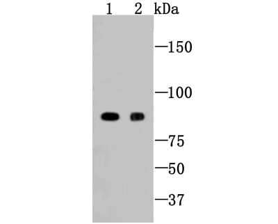 Western Blot: PARP Antibody (SU0314) [NBP2-67454] - Western blot analysis of PARP on diferent lysates using anti-PARP antibody at 1/1,000 dilution. Positive control: Lane1: Jurkat, Lane2: A549