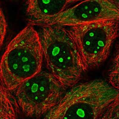 Immunocytochemistry/Immunofluorescence: PARP10 Antibody [NBP2-57056] - Staining of human cell line MCF7 shows localization to nucleoli, cytosol & vesicles. Antibody staining is shown in green. 