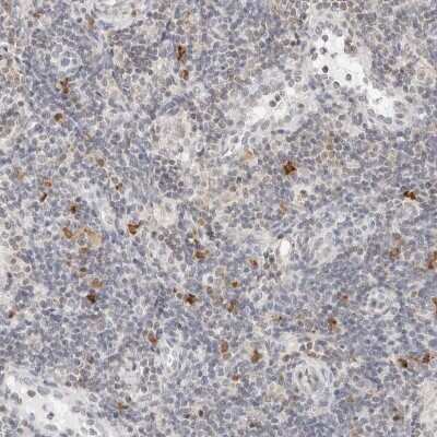 Immunohistochemistry-Paraffin: PARP10 Antibody [NBP1-83689] - Staining of human lymph node shows cytoplasmic positivity in non-germinal center cells.