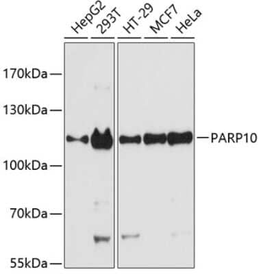 Western Blot: PARP10 Antibody [NBP2-93286] - Analysis of extracts of various cell lines, using PARP10 at 1:3000 dilution.Secondary antibody: HRP Goat Anti-Rabbit IgG (H+L) at 1:10000 dilution.Lysates/proteins: 25ug per lane.Blocking buffer: 3% nonfat dry milk in TBST.Detection: ECL Basic Kit .Exposure time: 90s.