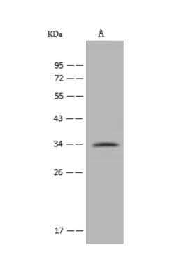 Western Blot: PARP16 Antibody [NBP3-06231] - Anti-PARP16 rabbit polyclonal antibody at 1:500 dilutionLane A: PC-3 Whole Cell LysateLysates/proteins at 30 ug per lane.SecondaryGoat Anti-Rabbit IgG (H+L) HRP at 110000 dilution.Developed using the ECL technique.Performed under reducing conditions.Predicted band size:36 kDaObserved band size:34 kDa