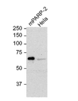 Western Blot: PARP2 Antibody (4G8) [NBP2-89041] - PARP-2, mAb (4G8) (1:50) on Hela cells (7.5x105).