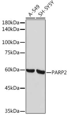 Western Blot: PARP2 Antibody (6G5U7) [NBP3-16618] - Analysis of extracts of various cell lines, using PARP2 Rabbit mAb (NBP3-16618) at 1:1000 dilution. Secondary antibody: HRP Goat Anti-Rabbit IgG (H+L) at 1:10000 dilution. Lysates/proteins: 25ug per lane. Blocking buffer: 3% nonfat dry milk in TBST. Detection: ECL Basic Kit. Exposure time: 60s.