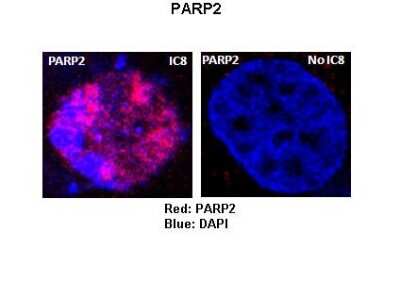 Immunocytochemistry/Immunofluorescence: PARP2 Antibody [NBP1-54680] - Rat thyrocytes-FRTL-5 Primary Antibody Dilution: 1 : 100 Secondary Antibody: Anti-rabbit-Texas Red Secondary Antibody Dilution: 1 : 100 Color/Signal Descriptions: Red: PARP2Blue: DAPI Gene name: PARP2 Submitted by: Syed A Morshed, Mount Sinai School of Medicine and James J Peters VA Medical Center.