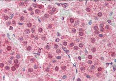 Immunohistochemistry-Paraffin: PARP2 Antibody [NB100-2556] -  (5ug/ml) staining of paraffin embedded Human Adrenal Gland. Steamed antigen retrieval with citrate buffer pH 6, AP-staining.