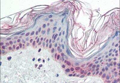 Immunohistochemistry-Paraffin: PARP2 Antibody [NB100-2556] -  (5ug/ml) staining of paraffin embedded Human Skin. Steamed antigen retrieval with citrate buffer pH 6, AP-staining.