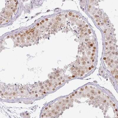 Immunohistochemistry-Paraffin: PARP2 Antibody [NBP2-47337] - Staining of human testis shows moderate nuclear positivity in cells in seminiferous ducts.