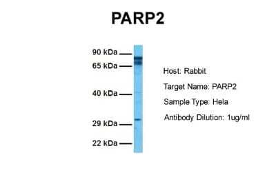 Western Blot: PARP2 Antibody [NBP1-54680] - Sample Tissue: Human Hela Antibody Dilution: 1.0 ug/ml