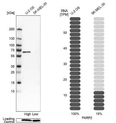 <b>Orthogonal Strategies Validation. </b>Western Blot: PARP2 Antibody [NBP2-47337] - Analysis in human cell line U-2 OS and human cell line SK-MEL-30.