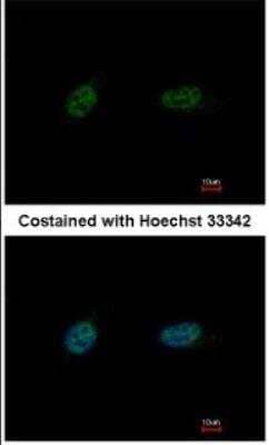 Immunocytochemistry/Immunofluorescence: PARP3 Antibody [NBP1-31415] - Paraformaldehyde-fixed HeLa, using antibody at 1:500 dilution.