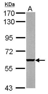 Western Blot: PARP3 Antibody [NBP1-31415] - Sample (50 ug of whole cell lysate) A: mouse heart 7.5% SDS PAGE diluted at 1:1000 The HRP-conjugated anti-rabbit IgG antibody (GTX213110-01) was used to detect the primary antibody.