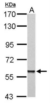 Western Blot: PARP3 Antibody [NBP1-31415] - A: mouse heart 7.5% SDS PAGE diluted at 1:1000 