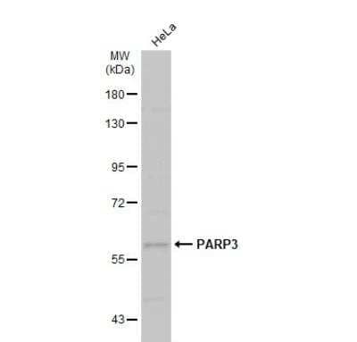 Western Blot: PARP3 Antibody [NBP1-31415] - Whole cell extract (30 ug) was separated by 7.5% SDS-PAGE, and the membrane was blotted with PARP3 antibody  diluted at 1:1000. The HRP-conjugated anti-rabbit IgG antibody (NBP2-19301) was used to detect the primary antibody, and the signal was developed with Trident ECL plus-Enhanced.