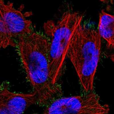 Immunocytochemistry/ Immunofluorescence PARP6 Antibody - BSA Free