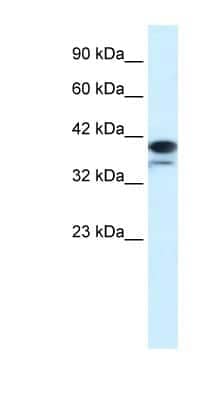Western Blot PARP6 Antibody - BSA Free