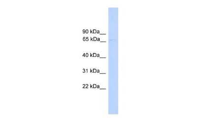 Western Blot PARP6 Antibody - BSA Free
