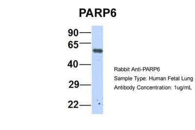 Western Blot PARP6 Antibody - BSA Free