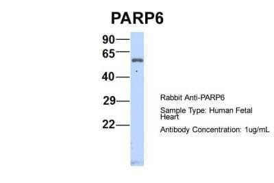 Western Blot PARP6 Antibody - BSA Free