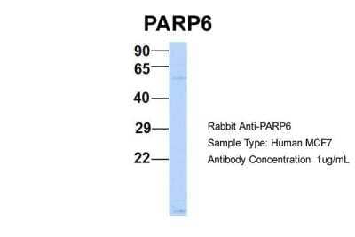 Western Blot: PARP6 Antibody [NBP2-85443] - Host: Rabbit. Target Name: PARP6. Sample Type: Human MCF7. Antibody Dilution: 1.0ug/mlPARP6 is supported by BioGPS gene expression data to be expressed in MCF7