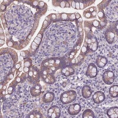 Immunohistochemistry-Paraffin: PARP8 Antibody [NBP2-13733] - Staining of human small intestine shows weak membranous positivity in glandular cells.