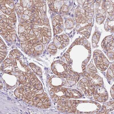 Immunohistochemistry-Paraffin: PARP8 Antibody [NBP2-13733] - Staining of human stomach shows moderate membranous positivity in glandular cells.