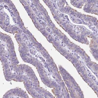 Immunohistochemistry-Paraffin: PARP8 Antibody [NBP2-13733] - Staining of human Fallopian tube shows weak  positivity in cilia in glandular cells.