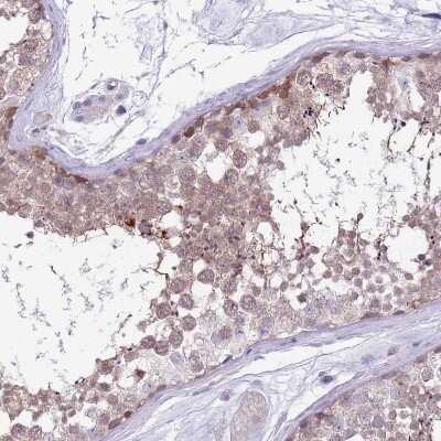 Immunohistochemistry-Paraffin: PARP8 Antibody [NBP2-13733] - Staining of human testis shows weak to moderate cytoplasmic positivity in cells in seminiferous ducts.