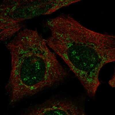 Immunocytochemistry/Immunofluorescence: PARS2 Antibody [NBP2-54971] - Staining of human cell line U-2 OS shows localization to nucleoli fibrillar center & mitochondria.