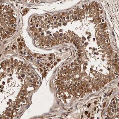 Immunohistochemistry-Paraffin: PARS2 Antibody [NBP1-84105] - Staining of human testis shows cytoplasmic positivity in cells in seminiferous ducts and Leydig cells.