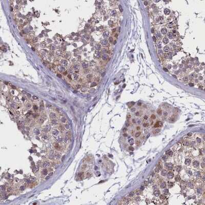 Immunohistochemistry-Paraffin: PARS2 Antibody [NBP2-33912] - Staining of human testis shows cytoplasmic positivity in cells in seminiferous ducts and Leydig cells.