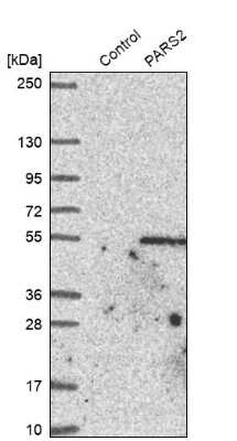 Western Blot: PARS2 Antibody [NBP1-84105] - Analysis in control (vector only transfected HEK293T lysate) and PARS2 over-expression lysate (Co-expressed with a C-terminal myc-DDK tag (3.1 kDa) in mammalian HEK293T cells).