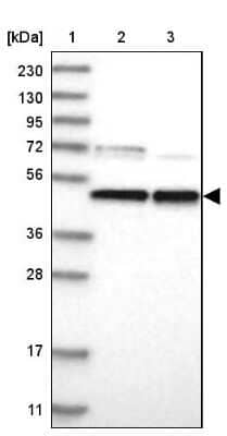 Western Blot: PARS2 Antibody [NBP2-33912] - Lane 1: Marker [kDa] 230, 130, 95, 72, 56, 36, 28, 17, 11Lane 2: Human cell line RT-4Lane 3: Human cell line U-251MG sp