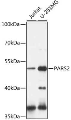 Western Blot: PARS2 Antibody [NBP2-94594] - Analysis of extracts of various cell lines, using PARS2 at 1:1000 dilution.Secondary antibody: HRP Goat Anti-Rabbit IgG (H+L) at 1:10000 dilution.Lysates/proteins: 25ug per lane.Blocking buffer: 3% nonfat dry milk in TBST.Detection: ECL Basic Kit .Exposure time: 10s.