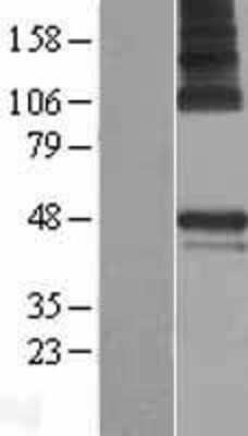 Western Blot: PARS2 Overexpression Lysate (Adult Normal) [NBP2-05415] Left-Empty vector transfected control cell lysate (HEK293 cell lysate); Right -Over-expression Lysate for PARS2.