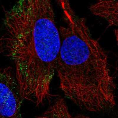 Immunocytochemistry/Immunofluorescence: PARVB Antibody [NBP2-57479] - Staining of human cell line HeLa shows localization to cytosol.