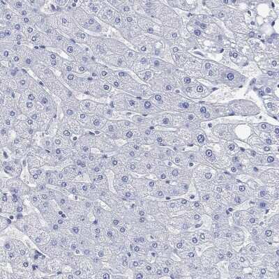 Immunohistochemistry-Paraffin: PARVB Antibody [NBP3-17063] - Staining of human liver shows low expression as expected.